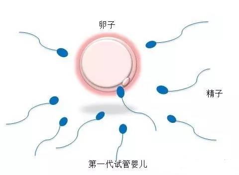 冷冻存储